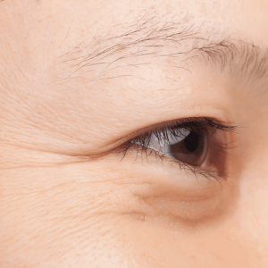 Close up of a person's eye with fine lines on the side